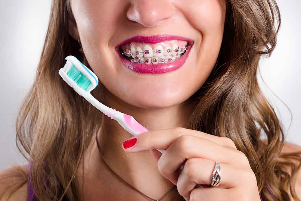 Best Toothpaste for Braces
